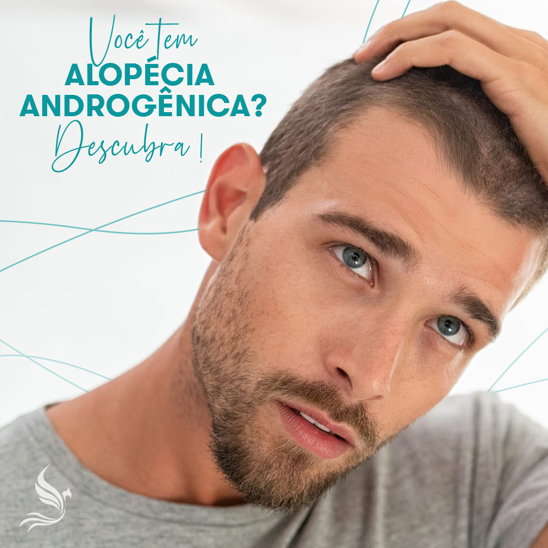 Você tem Alopécia androgênica? Descubra!